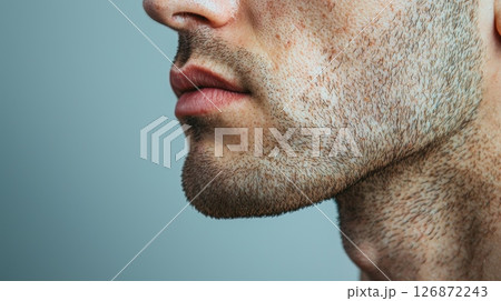 Close-Up of Male Face with Skin Condition Showing Freckles and Stubble Against a Neutral Background Close-Up of Male Face with Skin Condition Showing Freckles and Stubble Against a Neutral Background 126872243