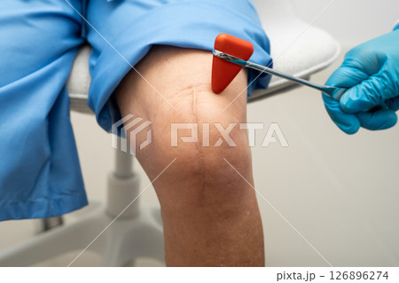 Asian doctor knock on knee reflex nerve for check and treatment senior patient in hospital. 126896274