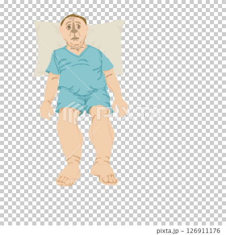 Medical illustration showing symptoms of right heart failure (elderly man, no text) | Visual symptoms such as lower leg edema, distended neck veins, and fluid retention 126911176