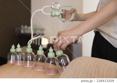 カッピングイメージ 126913209