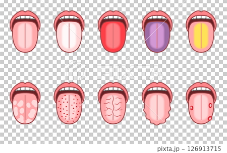 舌診，舌頭有各種症狀 126913715