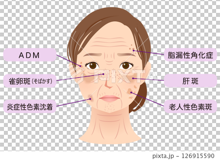 女人臉上有斑點，美麗，老年婦女 126915590