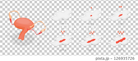 3D Isometric Flat  Illustration of Bleeding Menstrual Period, Women Periods, Menstrual Flow 126935726