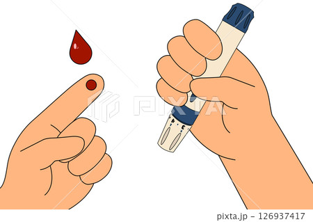 Finger prick for blood glucose testing using a lancet device. Scene of diabetes self-testing. Blood drop shown for glucose monitoring. Concept of diabetes mellitus, chronic illness and healthcare. Finger prick for blood glucose testing using a lancet device. Scene of diabetes self-testing. Blood drop shown for glucose monitoring. Concept of diabetes mellitus, chronic illness and healthcare. 126937417