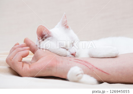 飼い主の腕の引っ掻き傷と猫 126945055