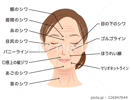 シワの種類　女性の顔　美容　シニア女性 126947644
