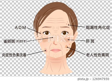 シミができた女性の顔　美容　シニア女性 126947930