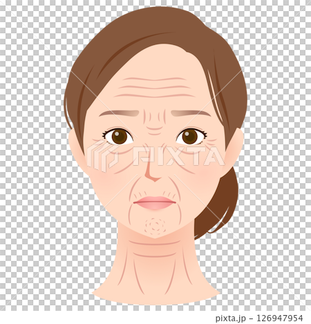 シワができた女性の顔 シワの種類 美容 シワができた女性の顔 シワの種類 美容 126947954