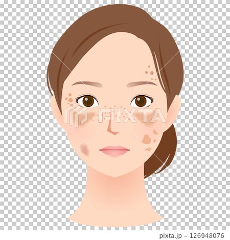 シミができた女性の顔　美容 126948076
