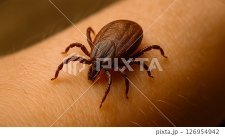 Close-up of a brown tick crawling on human skin with detailed texture and sharp focus 126954942