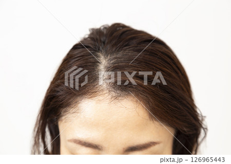 ミドル女性の生え際 ミドル女性の生え際 126965443