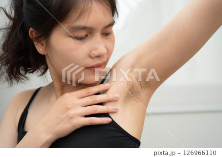 Asian woman have problem black armpit beauty skin care. 126966110
