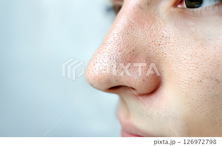 毛穴の黒ずみ 毛穴の黒ずみ 126972798