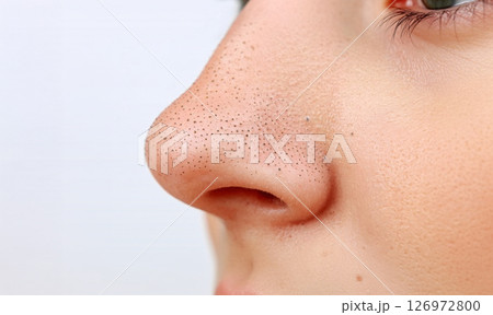 毛穴の黒ずみ 毛穴の黒ずみ 126972800