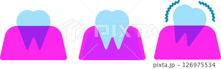 シンプルな歯の比較イラスト シンプルな歯の比較イラスト 126975534