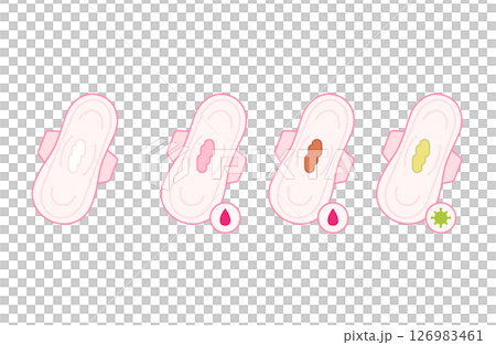 出血や細菌増殖が疑われるおりものの色セット 126983461