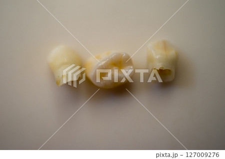 抜けた乳歯 127009276