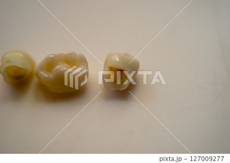 抜けた乳歯の中が空洞 127009277