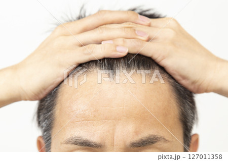 ミドル男性の生え際　白バック 127011358
