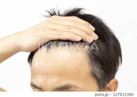 ミドル男性のおでこ 白バック ミドル男性のおでこ 白バック 127011360