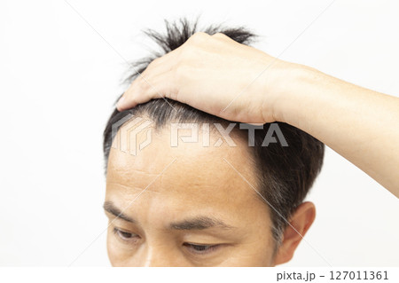 ミドル男性のおでこ 白バック ミドル男性のおでこ 白バック 127011361