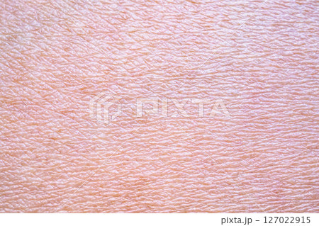 dry and dehydrated human skin texture background 127022915