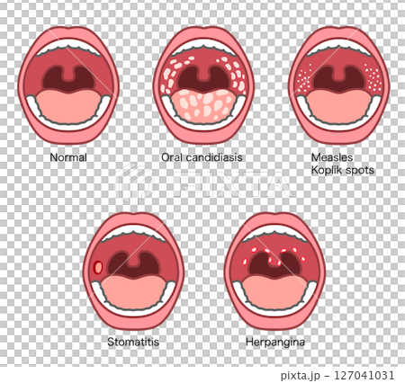 口腔症狀說明 口腔症狀說明 127041031