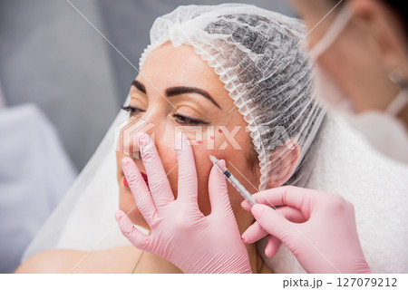 The doctor cosmetologist makes the facial injections procedure. The doctor cosmetologist makes the facial injections procedure. 127079212