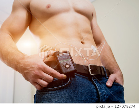 Diabetic man with an insulin pump connected in his abdomen and keeping the insulin pump Diabetic man with an insulin pump connected in his abdomen and keeping the insulin pump 127079274