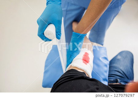 Nurse dressing wound for patient's hand with deep skin cutting. 127079297
