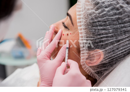 The doctor cosmetologist makes the facial injections procedure. The doctor cosmetologist makes the facial injections procedure. 127079341