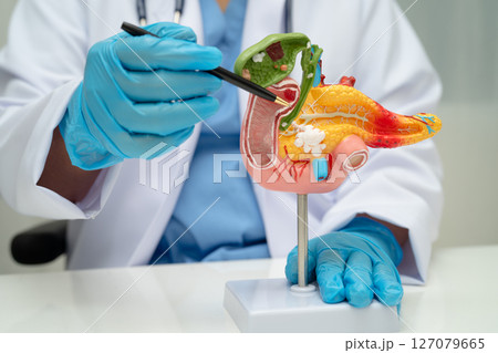 Pancreatitis, pancreatic cancer, Asian doctor with pancreas, gallbladder and bile duct human anatomy model at hospital. Pancreatitis, pancreatic cancer, Asian doctor with pancreas, gallbladder and bile duct human anatomy model at hospital. 127079665