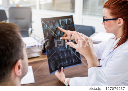 Doctors team having medical council in hospital. Spine fixation systems 127079987
