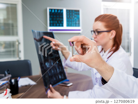 Doctors team having medical council in hospital. Spine fixation systems Doctors team having medical council in hospital. Spine fixation systems 127080619