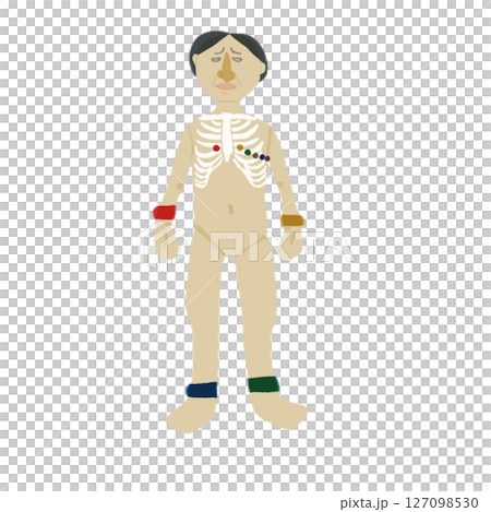 Illustration showing electrode positions for a 12-lead electrocardiogram | Chest and limb lead placement diagram 127098530