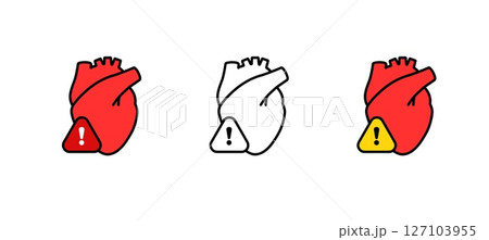 Heart with alert symbol in red and white variations showing warning concept Heart with alert symbol in red and white variations showing warning concept 127103955