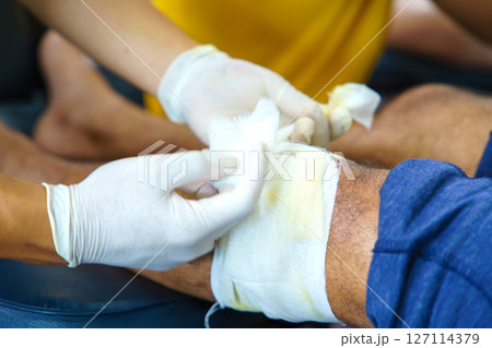 Knee pain in an elderly person use thai herbal compress ball or herbal on knee. Knee pain may cause from muscle strain, tendinosis, Knee osteoarthritis. Thai traditional medicin 127114379