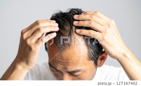 薄毛を気にする男性（AI生成画像） 127167402