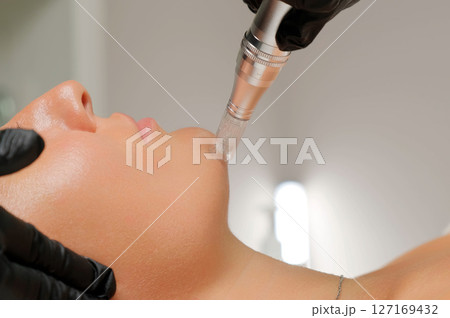 Microneedle RF lifting procedure. A cosmetologist performs a facial rejuvenation procedure on a woman. Hardware cosmetology. Microneedle RF lifting procedure. A cosmetologist performs a facial rejuvenation procedure on a woman. Hardware cosmetology. 127169432