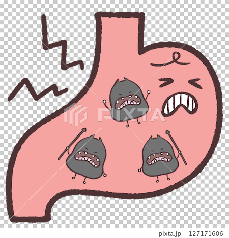 胃中細菌肆虐的插圖 127171606