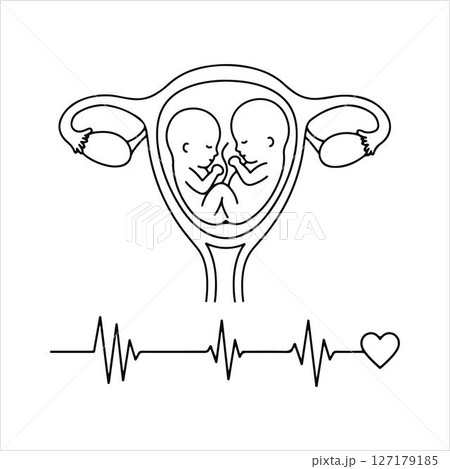 Obstetrics and Twin Health Monitoring. Line Drawing. Obstetrics and Twin Health Monitoring. Line Drawing. 127179185