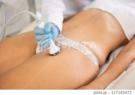 Anti aging thigh hardware therapy procedure for young female client in clinic of aesthetic medicine Anti aging thigh hardware therapy procedure for young female client in clinic of aesthetic medicine 127183472