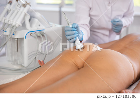 Anti-cellulite procedure on buttocks of young woman in beauty clinic 127183586
