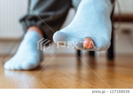 holey sock on teenager's foot 127188036