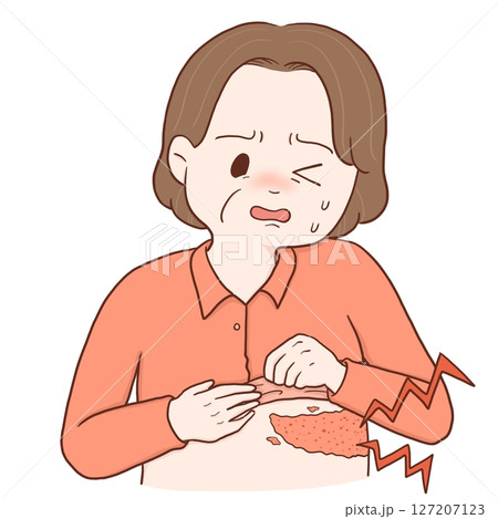 帯状疱疹の中年女性(カラー) 127207123