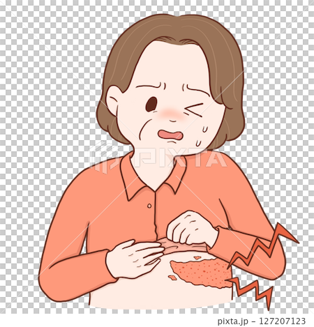 帯状疱疹の中年女性(カラー) 127207123