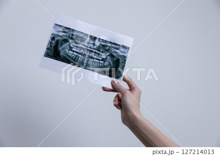 Hand Holding Dental X-Ray Image Taken to Analyze Oral Health and Dental Structure with Detailed View of Teeth for Professional Examination in Healthcare Environment Hand Holding Dental X-Ray Image Taken to Analyze Oral Health and Dental Structure with Detailed View of Teeth for Professional Examination in Healthcare Environment 127214013
