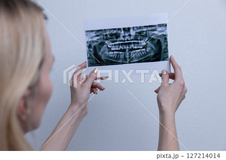 A Person Examining a Dental X-Ray Image in a Well-Lit Environment, Highlighting Professionalism in Oral Healthcare and Patient Awareness A Person Examining a Dental X-Ray Image in a Well-Lit Environment, Highlighting Professionalism in Oral Healthcare and Patient Awareness 127214014