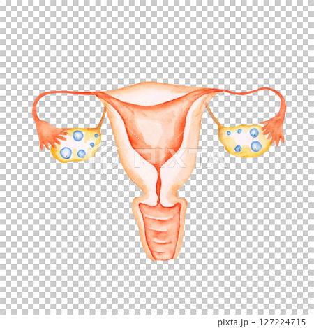Infertility, pregnancy, female genitals, reproductive system, uterus, watercolor illustration 127224715