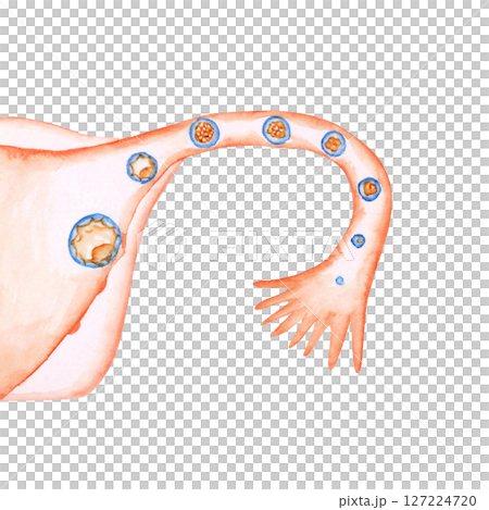 Infertility, pregnancy, uterus, fertilized egg, implantation, watercolor illustration 127224720